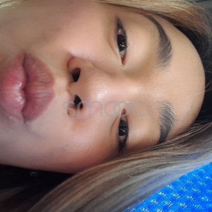 VersaTranelaAppleGarcia – Hi again